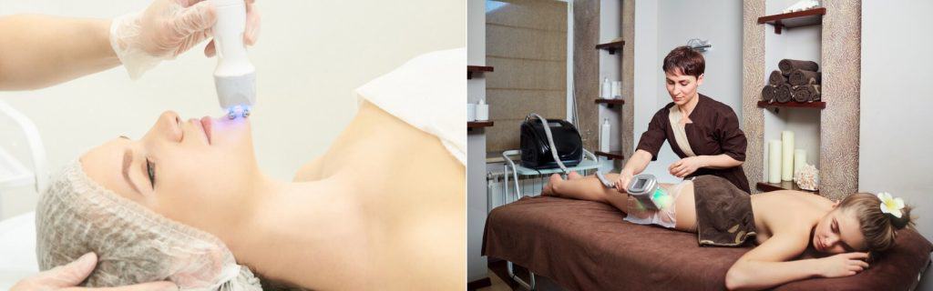 CoolSculpting