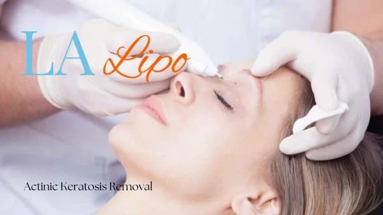 Woman receiving Actinic Keratosis Removal Treatment Hatfield
