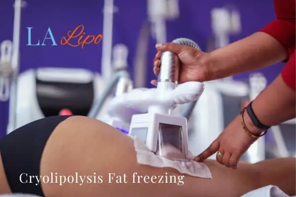 women getting fat freezing Hatfield