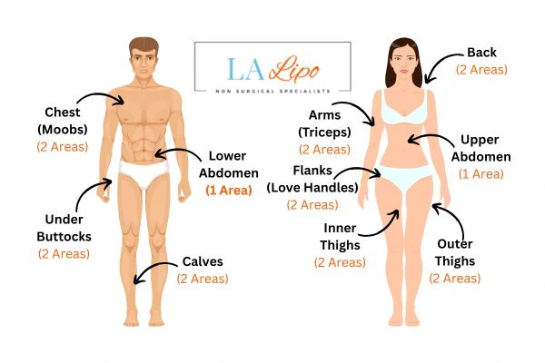 LA LIPO Cryolipolysis Areas Hatfield