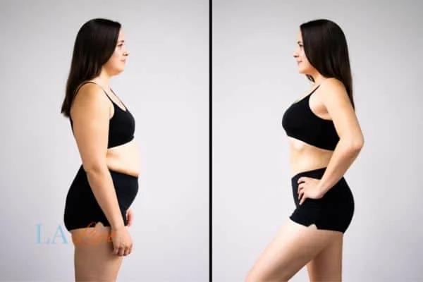 link between body image and mental health Hatfield