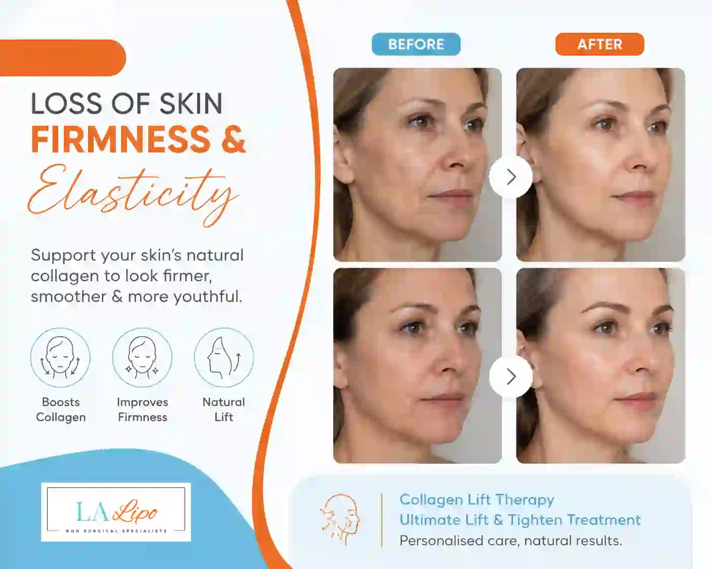 Sign #7: Loss of Skin Firmness and Elasticity Hatfield